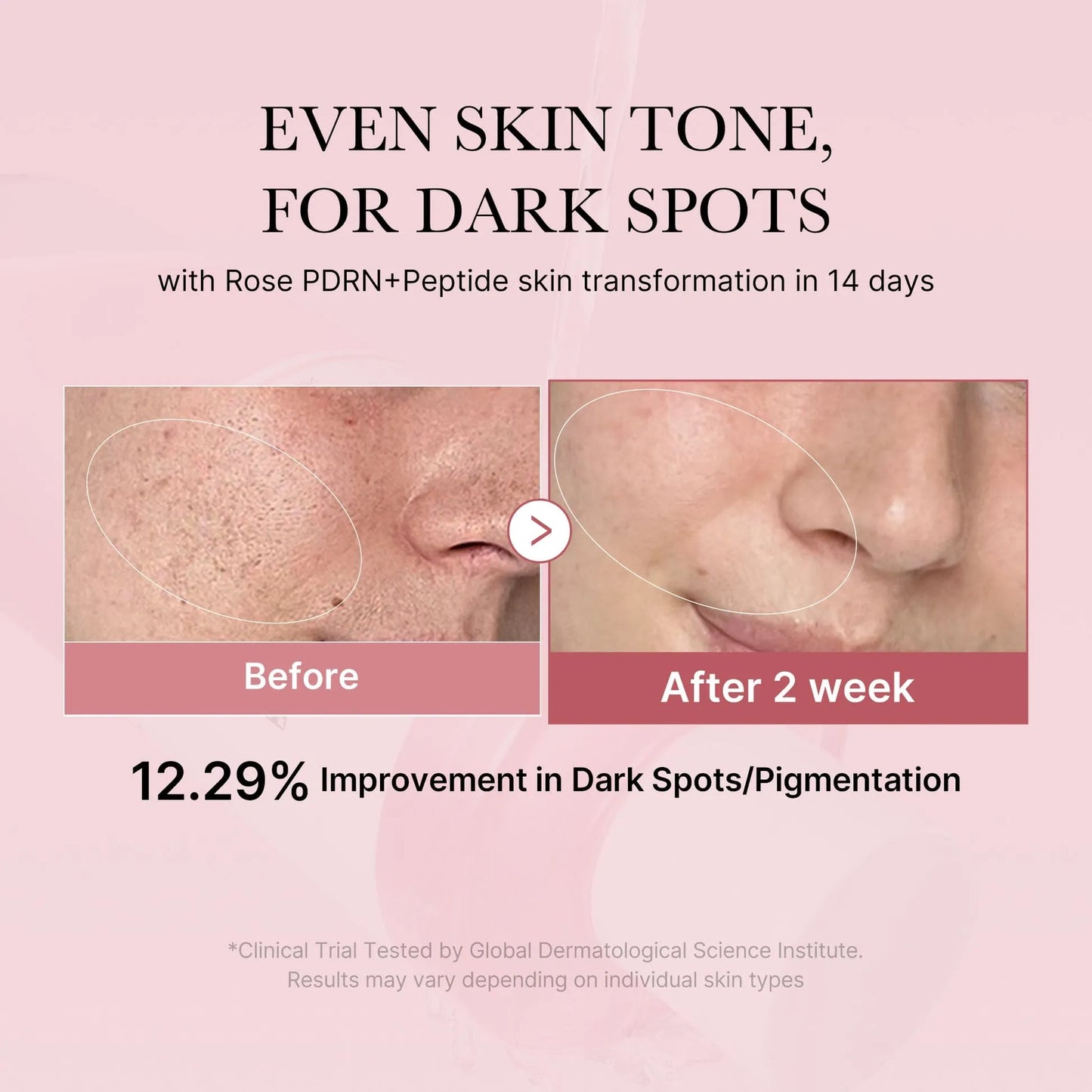 PDRN Pink Collagen Volume Multi Balm 10g