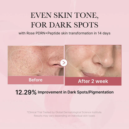 PDRN Pink Collagen Volume Multi Balm 10g
